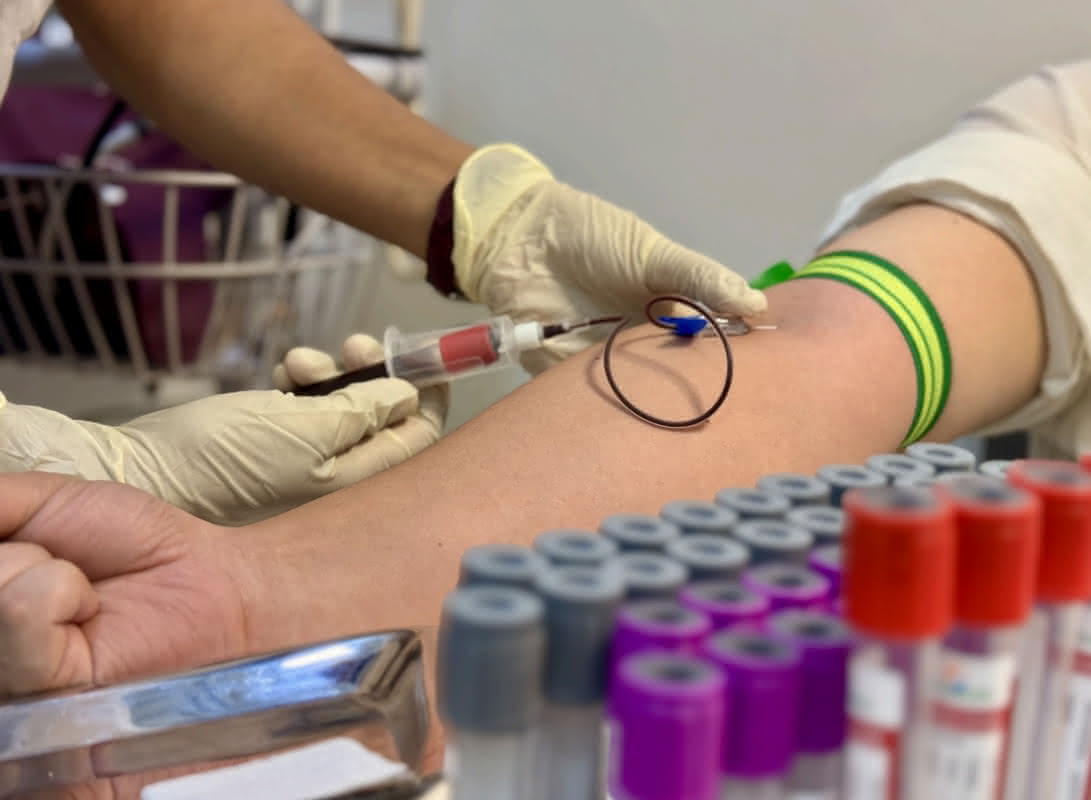 Laboratory testing vials and medical test tubes - Professional lab testing facility with blood analysis equipment, hormone testing kits, and diagnostic specimen vials at Healers Clinic Dubai